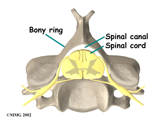 Spinal Stenosis - Vancouver Spine Doctor